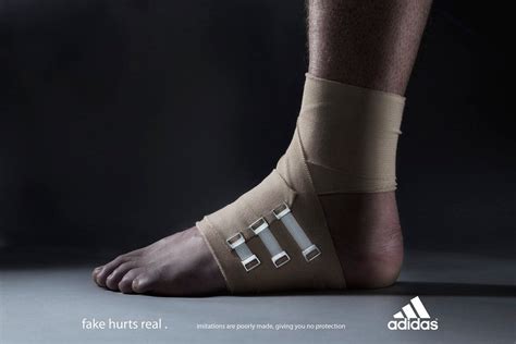 fake hurts real adidas|adidas world cup advert.